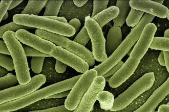 Green, rod-shaped bacteria seen under high magnification (SEM), densely clustered.