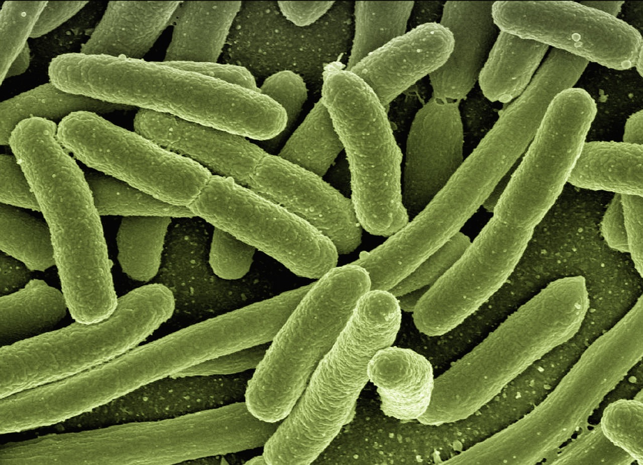 Green, rod-shaped bacteria seen under high magnification (SEM), densely clustered.
